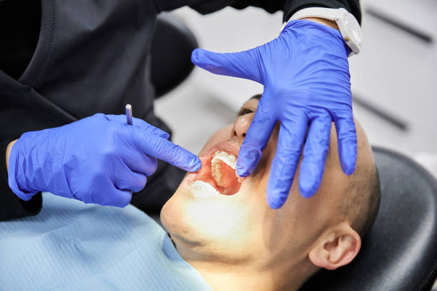 Best Broken Tooth Emergency  in Wilsons Mills, NC