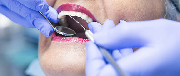 Best Knocked-Out Tooth Emergency  in Wilsons Mills, NC